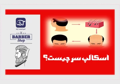 اسکالپ سر چیست