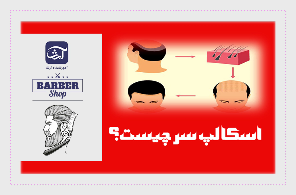 اسکالپ سر چیست