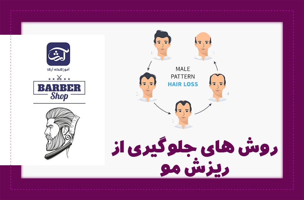 جلوگیری از ریزش مو و روش های آن