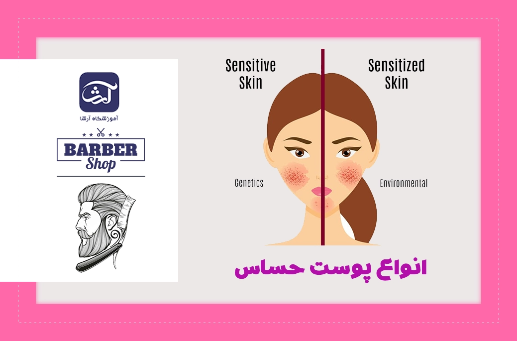 پوست حساس و انواع آن