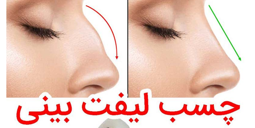 چسب برای بینی های استخوانی