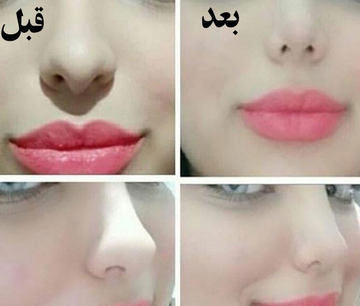 چسب بینی در آرایشگاه